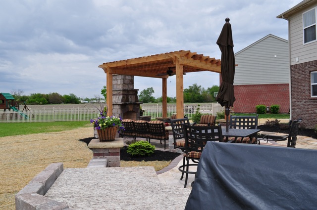 Outdoor Living Space with Pergola and Fireplace